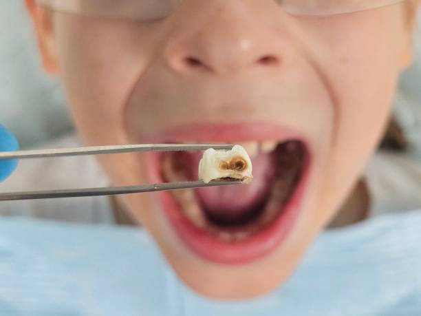 Best Emergency Denture Repair in Gman, IL