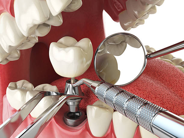 Best Emergency Treatment for Dental Infections or Abscesses in Gman, IL